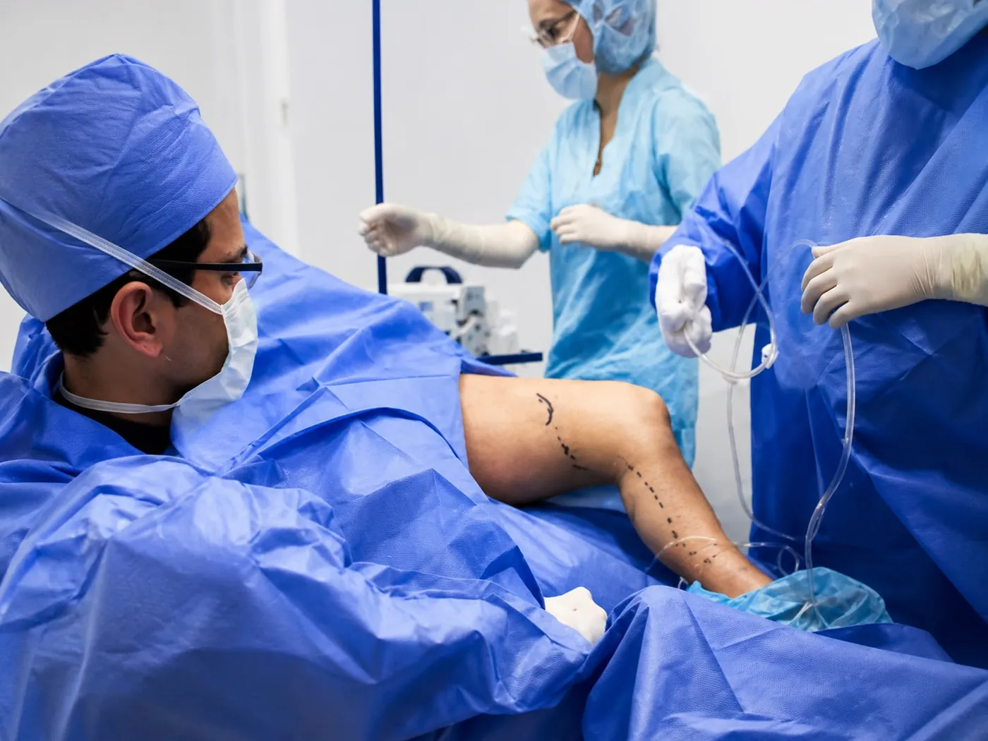 Cirujano vascular en sala de procedimientos con el trayecto de la vena marcado en la pierna del paciente